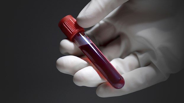 lyme disease blood test